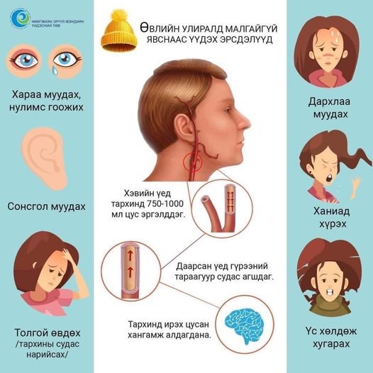 Хүйтэн сэрүүний улиралд гадаа гарахдаа тогтмол малгай өмсөж хэвшээрэй